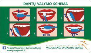 šilumokaitis valymo schema