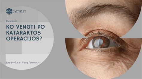 Kataraktos operacijos vizualizacijos infografika