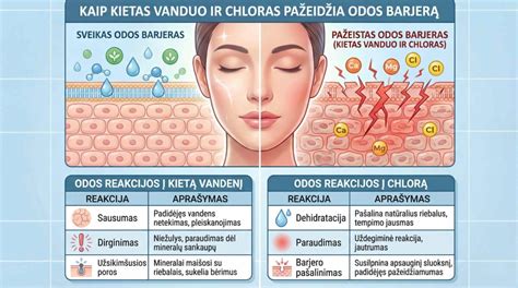 Palyginimas: kieto ir minkšto vandens poveikis odai