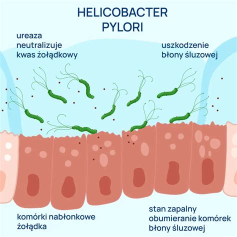 Infografika: Helicobacter pylori bakterijos poveikis skrandžiui