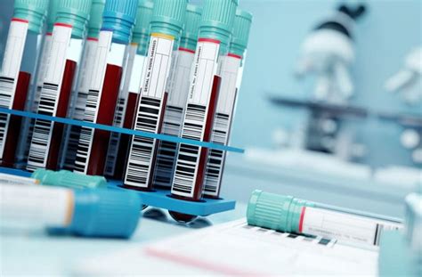 laboratoriniai nuotekų tyrimai